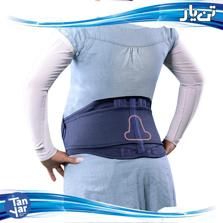 کمربند بارداری